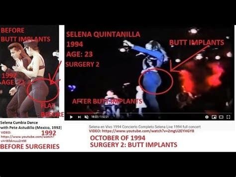 Selena Quintanilla before and after 1994 butt surgery/ implants